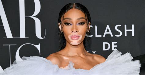 winnie harlow net worth|Winnie Harlow Net Worth 2024: What Is The Model。